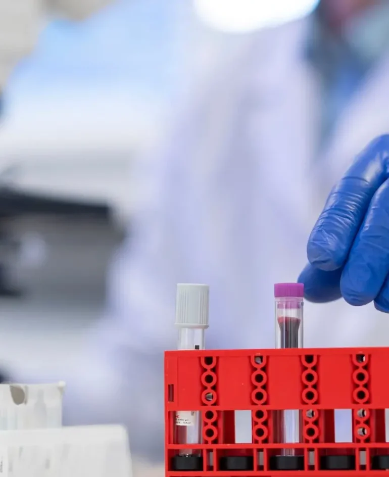 Doctor working in hematology